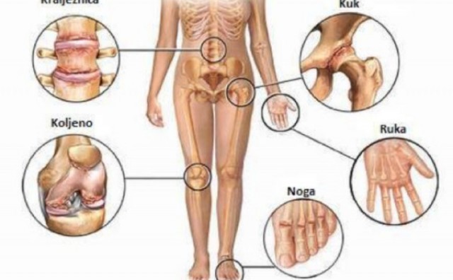 vijesti u liječenju artroze zglobova