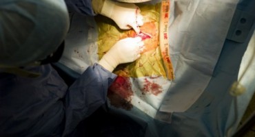 555 DANA BEZ SRCA: Zahvaljujući aparatima mladić je živio bez srca od 2014. godine