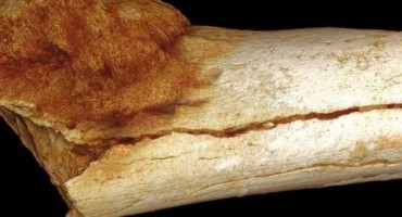 Rak pronađen na fosilu starom 1,7 milijuna godina