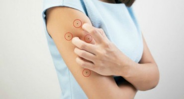 mladeži na desnoj ruci, istraživanje