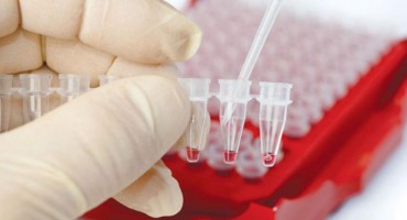 Analizom krvi moguće otkriti rak