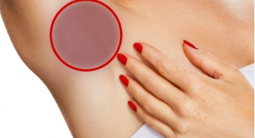 ozbiljni problemi, promjene, koža