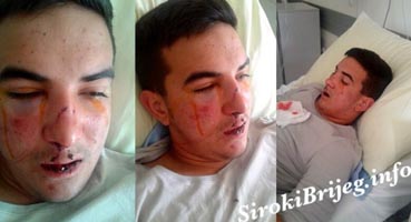 Pismo majke pretučenog dječaka iz Širokog Brijega