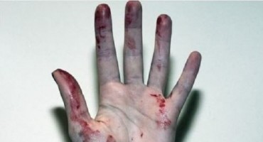 letak, hit, društvene mreže