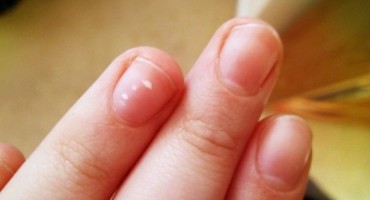 Imaš tanke nokte koji stalno pucaju? Možda će ovo pomoći!