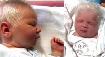 Dječak rođen s bijelom kosom