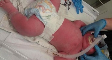 Mrtvu bebu su joj izvadili iz stomaka: Ubrzo je uslijedilo čudo koje je šokiralo ljekare, pa i svijet!