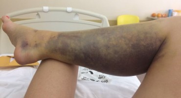 Marina Maslek: Saga o poskoku ili o nemoralnim hlačicama