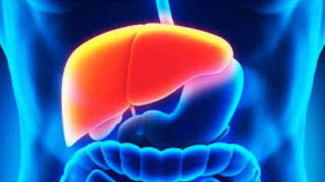 hepatitis