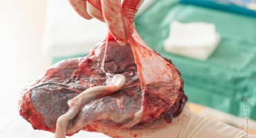 Stručnjaci imaju nove dokaze: Nemojte jesti posteljicu