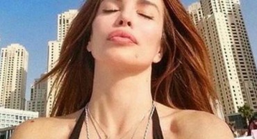 Severina ugradila hijaluronske filere u obraze