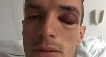 Nekadašnji Plemić Jasmin Mešanović uspješno operiran u Mariboru