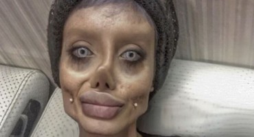 Htjela izgledati poput Angeline Jolie, a izgleda kao 'Mrtva mladenka'!