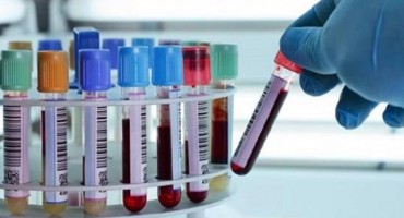 Rak je možda povezan s konzumacijom industrijski prerađene hrane