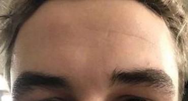 Ljepotica, ali i zvijer: Cura mu slomila nos jer je htio prekinuti 