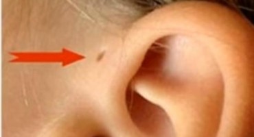 Malo ljudi ima ovu rupicu iznad uha, a ona ih čini posebnima