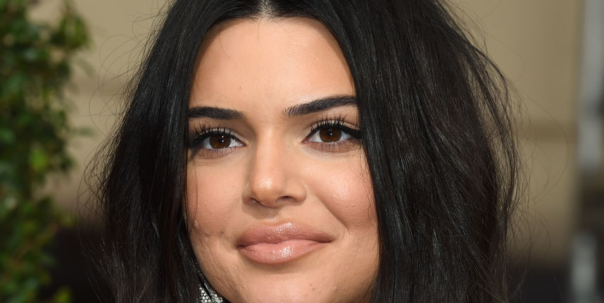 Kendall Jenner opet na udaru: 'Definitivno je stavila filere u usne i obraze'