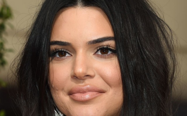 Kendall Jenner opet na udaru: 'Definitivno je stavila filere u usne i obraze'