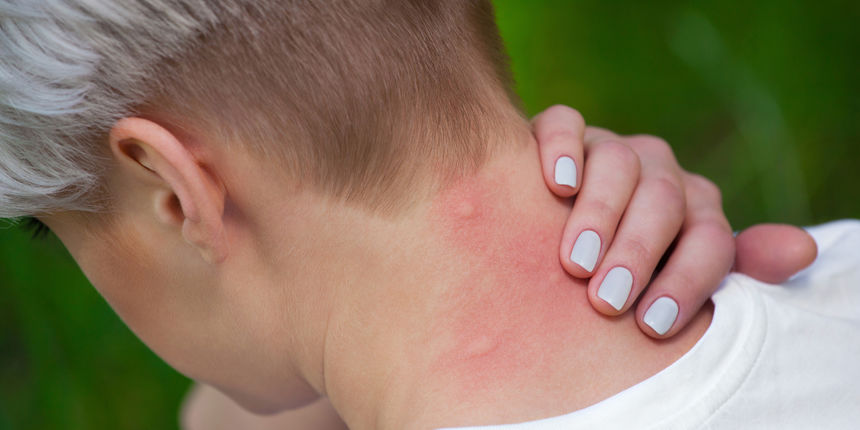 Prvi slučaj virusa Zapadnog Nila u BiH: 'Pratimo epidemiološku situaciju i u zemljama regije'