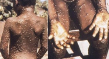 Iz Afrike u Europu stigla nova virusna bolest za koju nema cjepiva, evo o čemu se radi