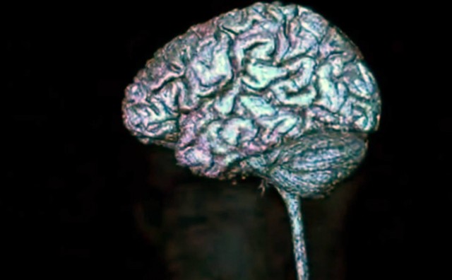 Ljudi koji često zaboravljaju su zapravo - izuzetno inteligentni