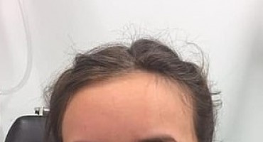  Djevojčica skoro ostala slijepa nakon što je za Halloween nosila leće u boji 