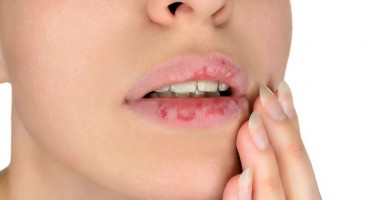 Pripazite! Šest znakova na tijelu da ste pod prevelikim stresom