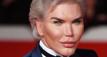  Ljudski Ken ide na najveću operaciju u životu i dosad najbizarniju 