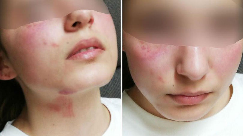 Zagreb: Izašao iz zatvora čuvati djecu pa brutalno pretukao maloljetnu kćer