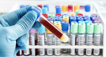 Prvi smrtni slučaj od virusa gripe u Mostaru