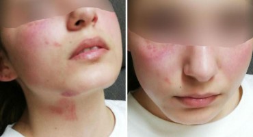 Zagreb: Izašao iz zatvora čuvati djecu pa brutalno pretukao maloljetnu kćer