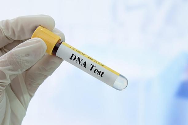 Par iz šale napravio DNK test pa doznali nešto što im je promijenilo živote