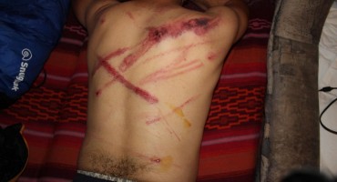 Novinari BBC-a tvrde: Hrvatski policajci su brutalno pretukli migrante, imaju ozljede glave i slomljene ruke