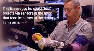 država Utah, SAD, proteza