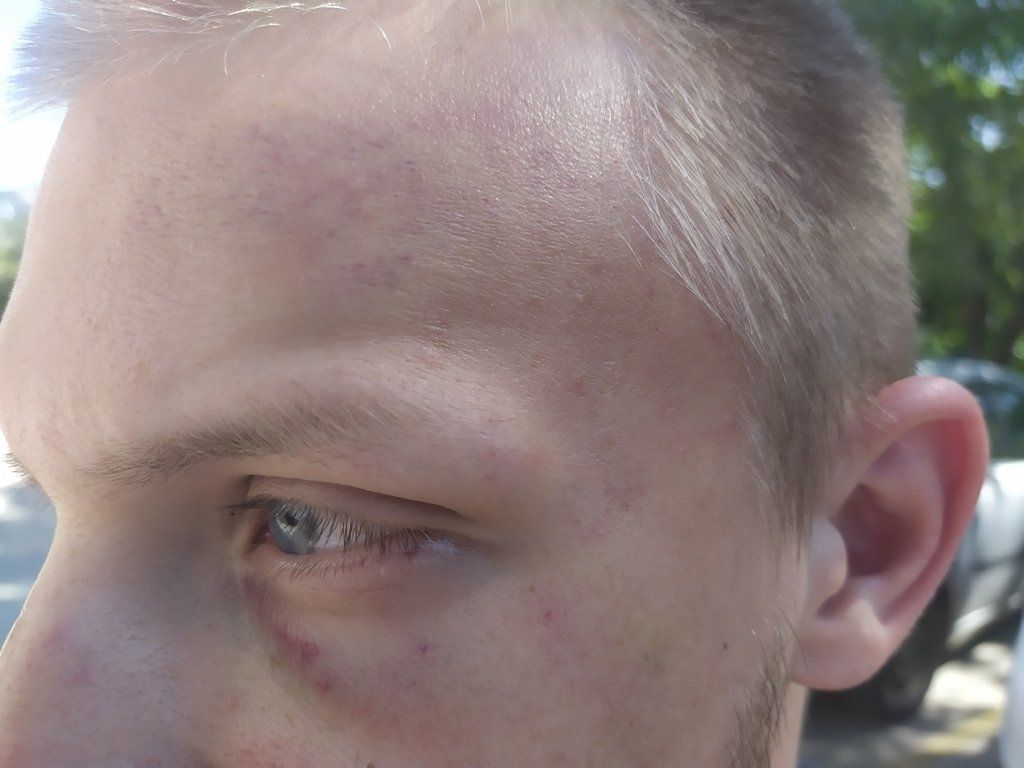 Turist iz Mađarske brutalno pretučen u Mostaru
