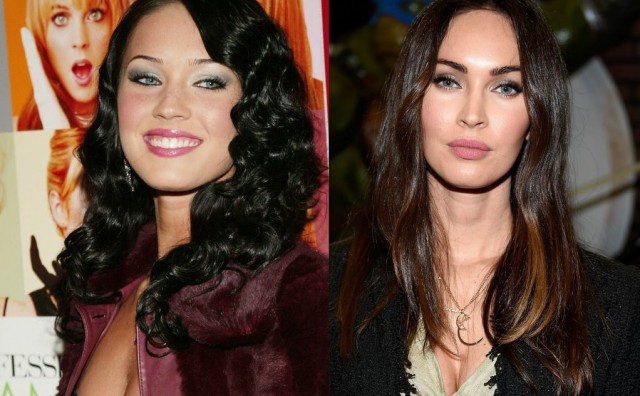 10 slavnih žena koje su jednom plastičnom operacijom promijenile izgled cijelog lica