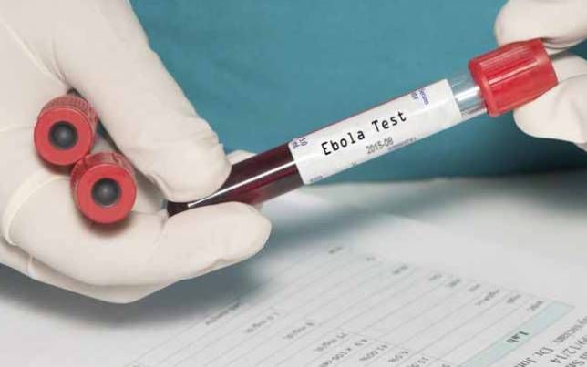 Novi računalni model predviđa gdje će izbiti sljedeća epidemija ebole