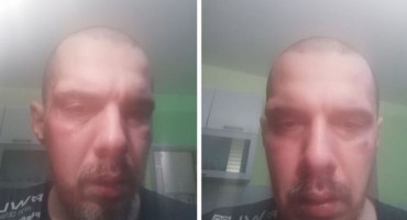 Pjevač Bojan Tomović pretučen u Beogradu