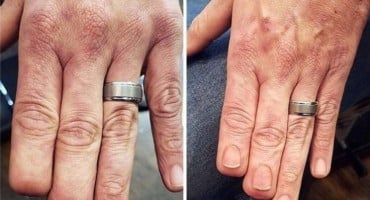 Pogledajte kako su ovi ljudi svoje ožiljke pretvorili orginalne tetovaže