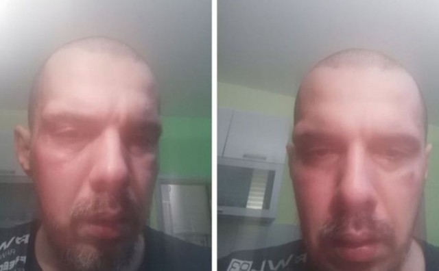 bojan tomović, pretučen