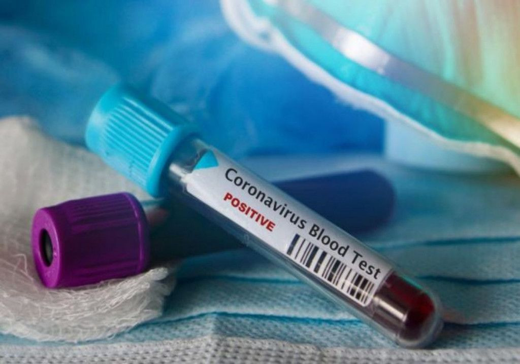 SUMNJA SE NA KORONAVIRUS Muškarac u izolaciji u osječkoj bolnici