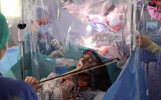 Žena svirala violinu za vrijeme operacije tumora na mozgu
