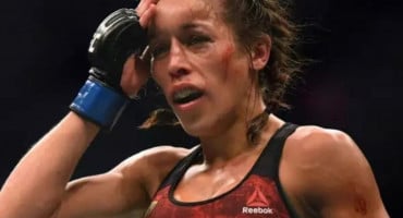 Pogledajte lice Poljakinje tjedan dana nakon najboljeg UFC ženskog meča ikada