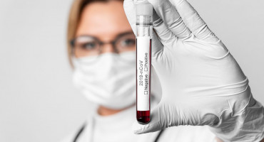  ŽZH Nema novih slučajeva zaraze koronavirusom, osam testova negativno