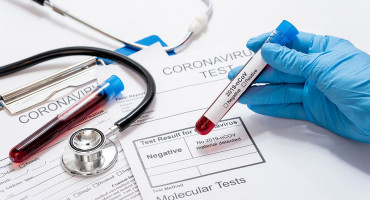 Četiri nova slučaja zaraze koronavirusom u HNŽ-u