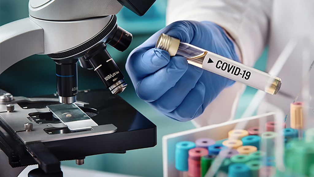 KORONAVIRUS Ovo su novi podaci o broju zaraženih i umrlih u BiH u 24 sata