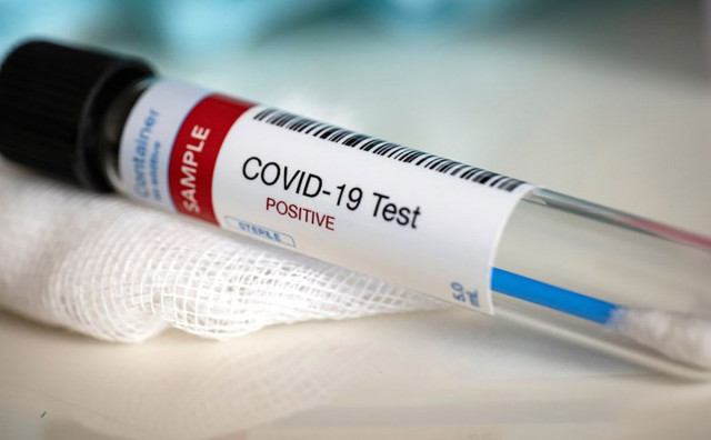 U BiH 302 nova slučaja zaraze koronavirusom, jedna osoba preminula