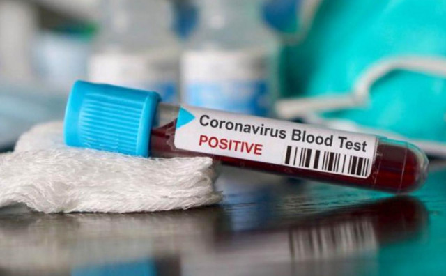 Koronavirus covid-19