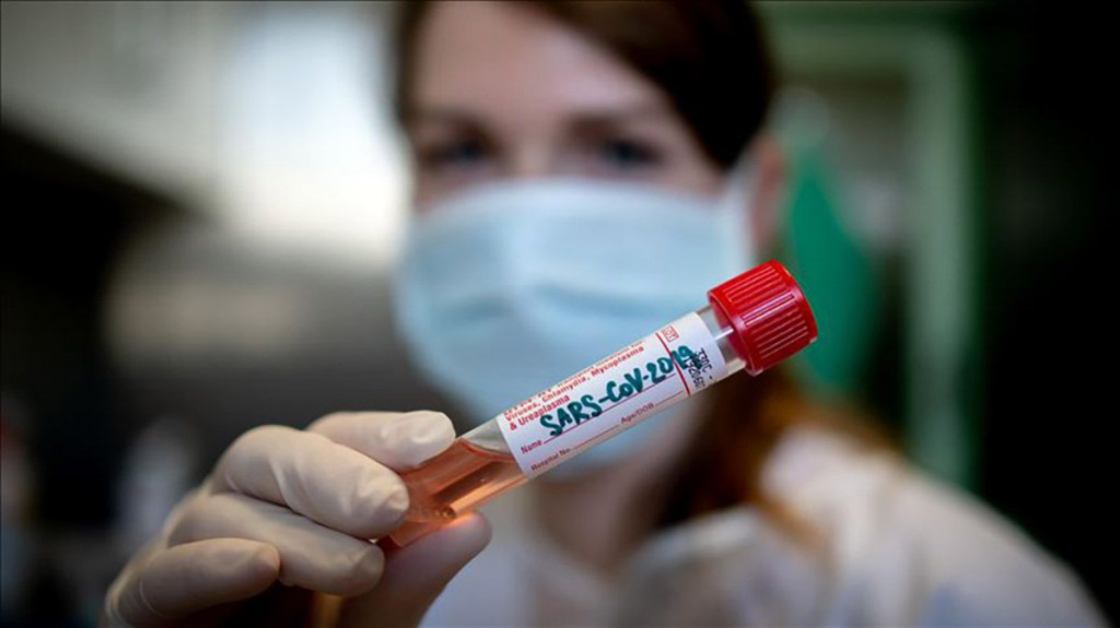 Virus u BiH potvrđen kod još 439 osoba