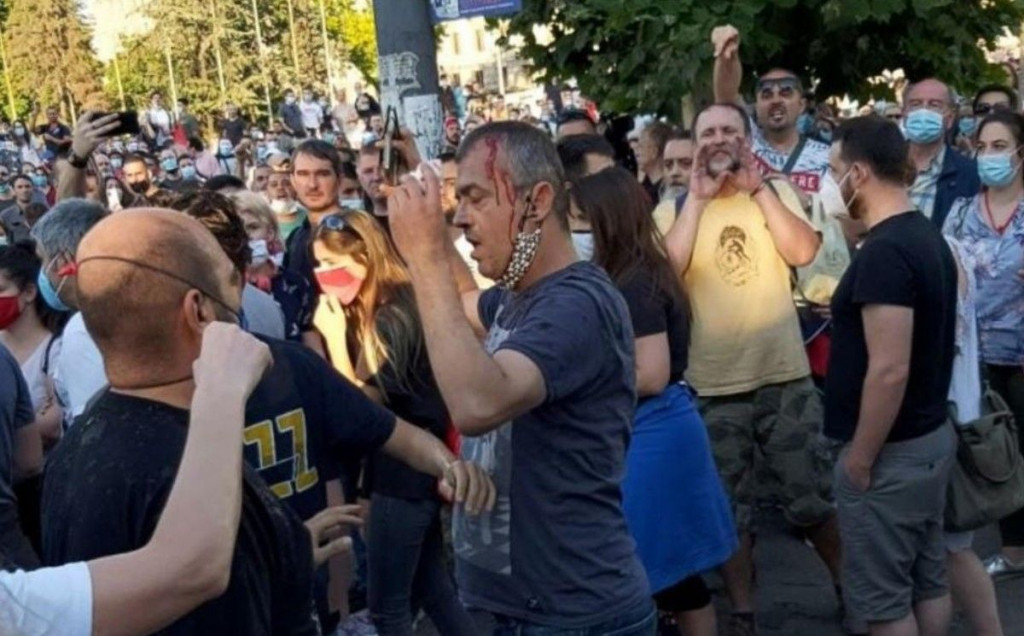 NAPETO U BEOGRADU Napadnut Sergej Trifunović, krvave glave otjeran od strane prosvjednika